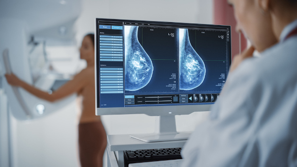  Médico analisando resultado de mamografia de paciente ainda no aparelho.