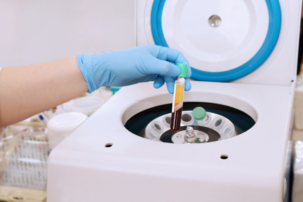 Biomédico colocando um tubo de sangue no equipamento que realiza centrifugação, um dos métodos de separação de misturas.