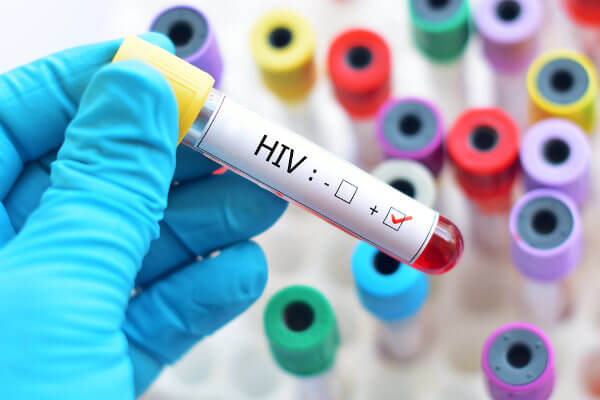 O HIV é um exemplo de vírus que pode ser transmitido por via sexual.